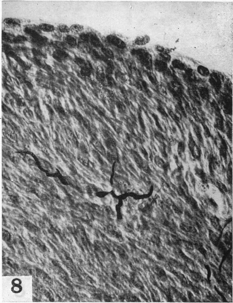 https://cdn.ncbi.nlm.nih.gov/pmc/blobs/6092/1252633/ff455323dd92/janat00517-0098-d.jpg