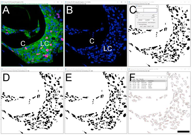 https://cdn.ncbi.nlm.nih.gov/pmc/blobs/6094/7856428/1bd2b4558696/gr5.jpg