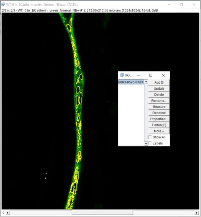 https://cdn.ncbi.nlm.nih.gov/pmc/blobs/6094/7856428/358eb9f0ae7c/fx47.jpg