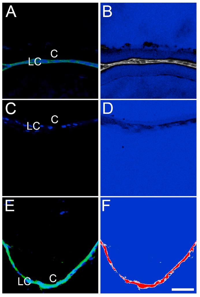 https://cdn.ncbi.nlm.nih.gov/pmc/blobs/6094/7856428/667efd84dd44/gr1.jpg