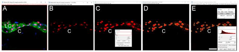https://cdn.ncbi.nlm.nih.gov/pmc/blobs/6094/7856428/9311be673ed4/gr4.jpg
