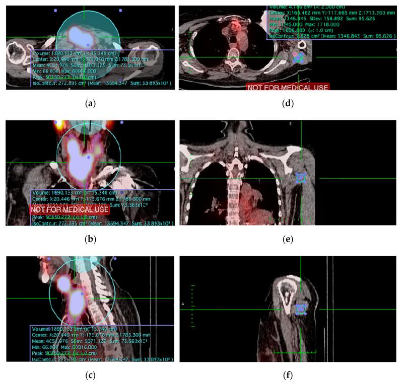 https://cdn.ncbi.nlm.nih.gov/pmc/blobs/6097/8003652/10bd8533e725/diagnostics-11-00553-g002.jpg