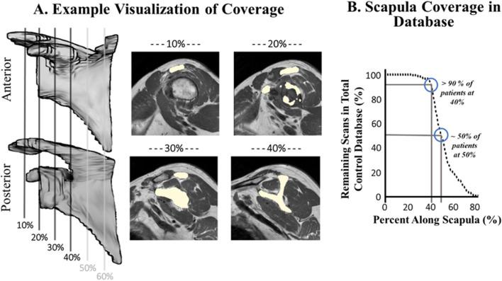 https://cdn.ncbi.nlm.nih.gov/pmc/blobs/609a/10474276/fe7520804bd3/41598_2023_41599_Fig4_HTML.jpg