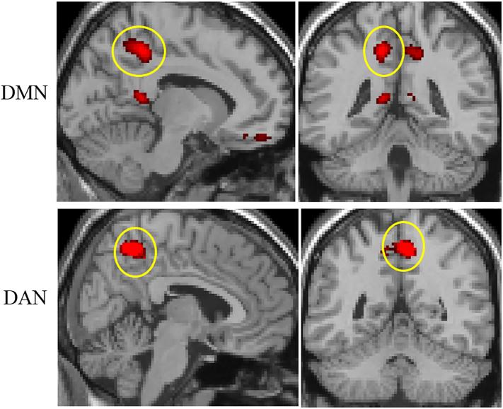 https://cdn.ncbi.nlm.nih.gov/pmc/blobs/609b/5542421/ecad1c0476e3/gr1.jpg