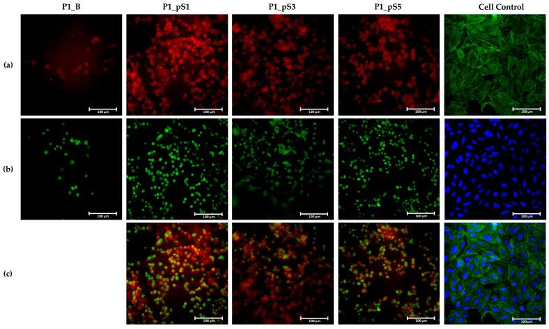 https://cdn.ncbi.nlm.nih.gov/pmc/blobs/609c/9863008/775e2ba7e38f/ijms-24-01128-g010.jpg
