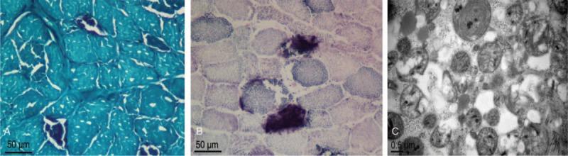 https://cdn.ncbi.nlm.nih.gov/pmc/blobs/60a3/5704856/1a2aef3896eb/medi-96-e8716-g002.jpg