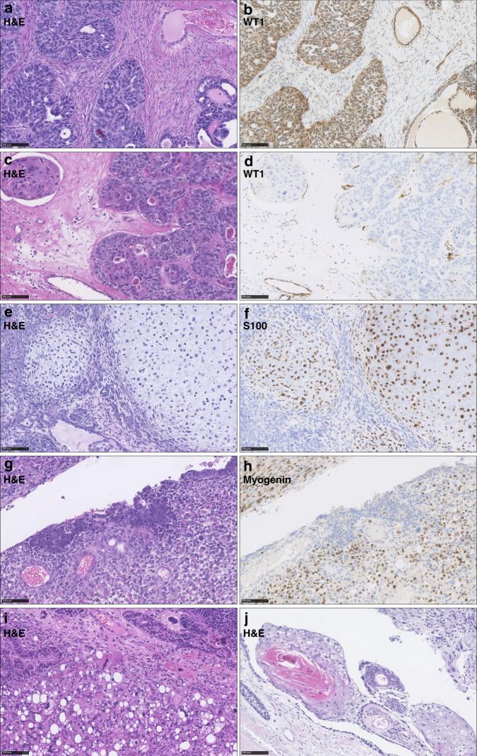 https://cdn.ncbi.nlm.nih.gov/pmc/blobs/60a5/9470739/04a3ea01c09f/41416_2022_1874_Fig2_HTML.jpg