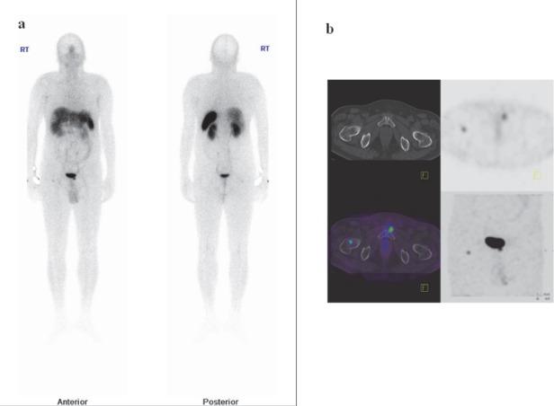 https://cdn.ncbi.nlm.nih.gov/pmc/blobs/60ae/4937710/f6c68bbf37d6/AOJNMB-2-30-g004.jpg
