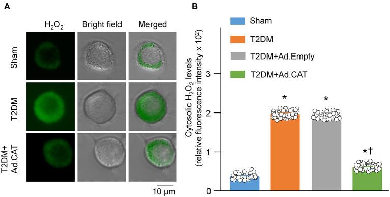 https://cdn.ncbi.nlm.nih.gov/pmc/blobs/60ae/9082497/b8c3d0f84d2a/fcvm-09-871852-g0001.jpg