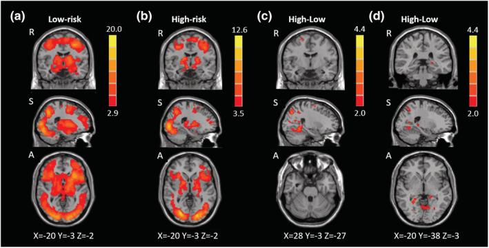 https://cdn.ncbi.nlm.nih.gov/pmc/blobs/60af/9290961/7f205a443820/EJN-54-5310-g001.jpg
