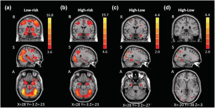 https://cdn.ncbi.nlm.nih.gov/pmc/blobs/60af/9290961/c2595a1284f0/EJN-54-5310-g003.jpg
