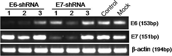 https://cdn.ncbi.nlm.nih.gov/pmc/blobs/60b1/4695162/8205cdb8ac13/oncotarget-06-23930-g001.jpg