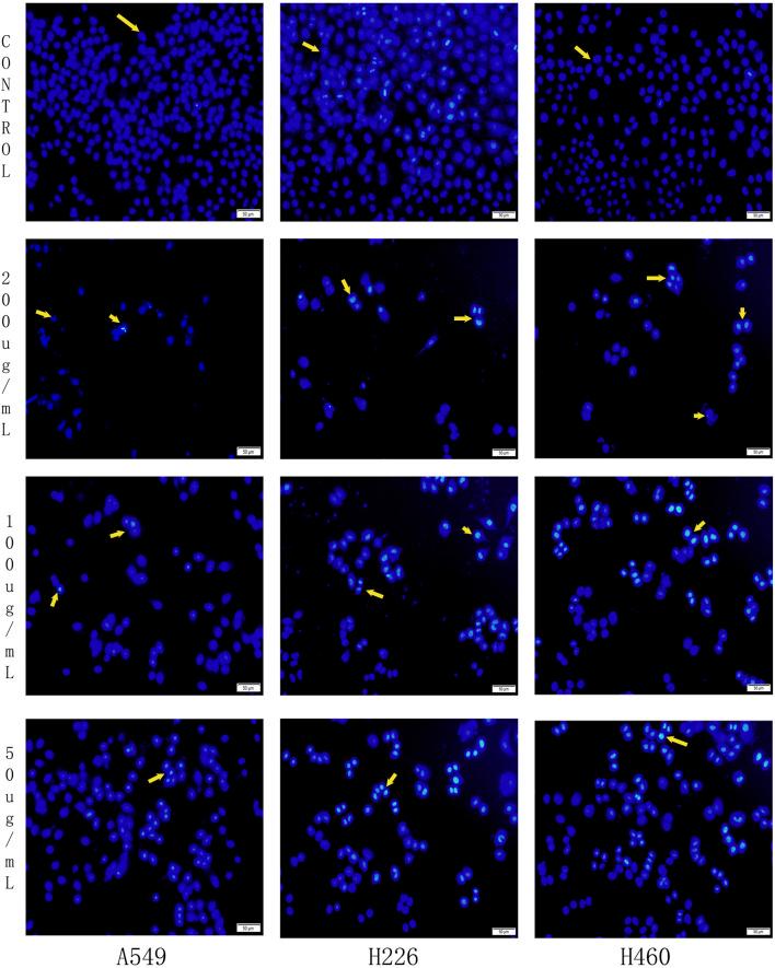 https://cdn.ncbi.nlm.nih.gov/pmc/blobs/60b3/12107193/bb6c317425b3/fphar-16-1526952-g007.jpg