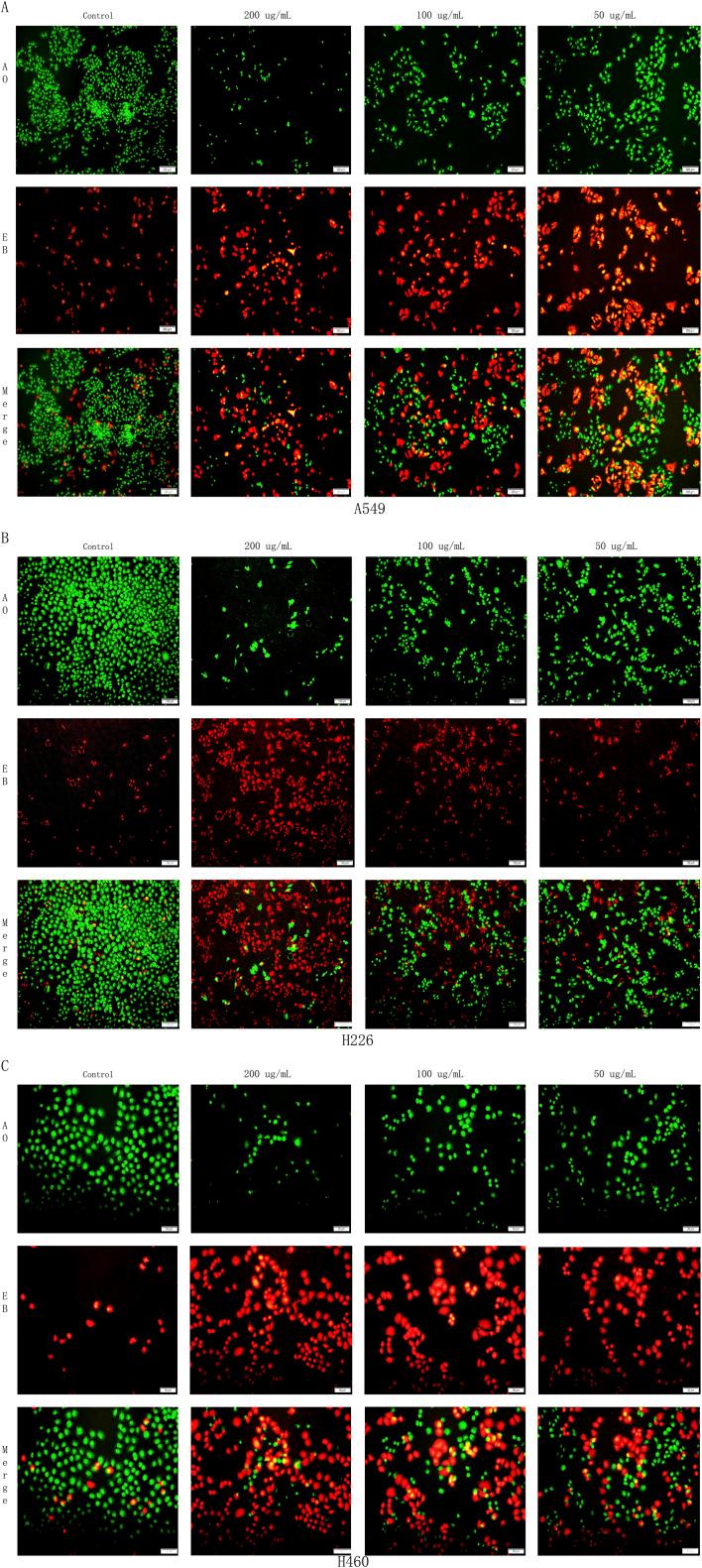 https://cdn.ncbi.nlm.nih.gov/pmc/blobs/60b3/12107193/c142734e29c3/fphar-16-1526952-g009.jpg