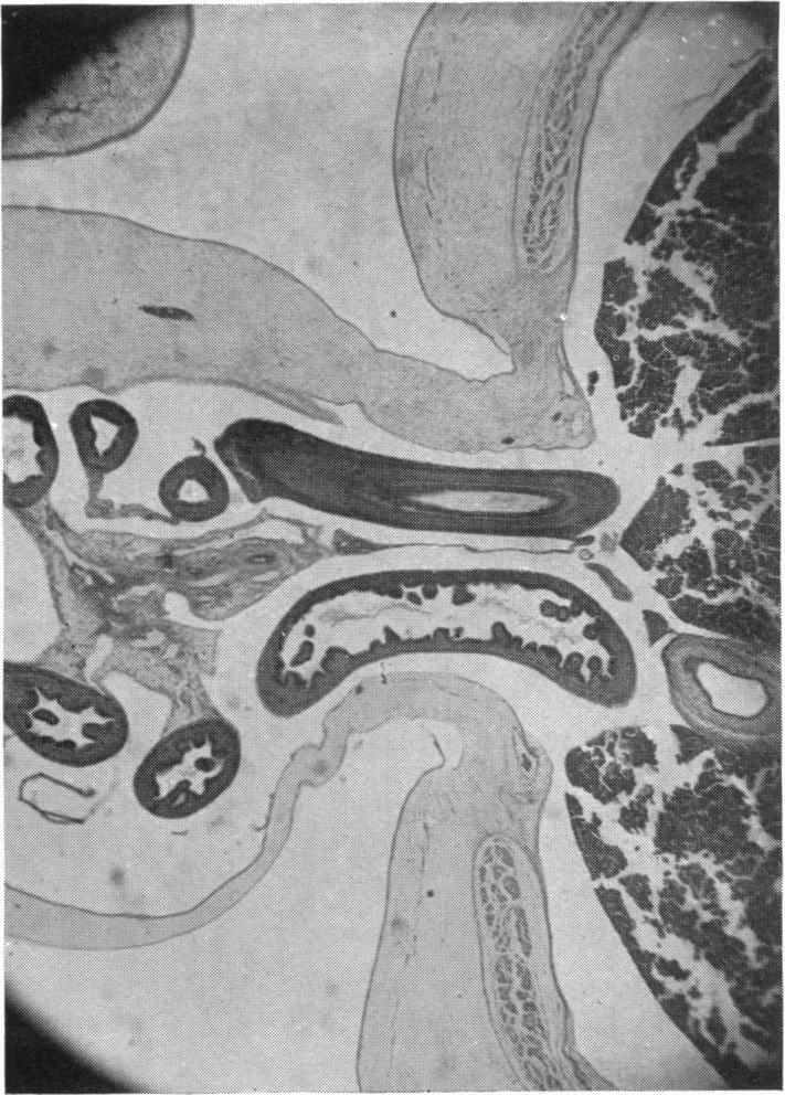 https://cdn.ncbi.nlm.nih.gov/pmc/blobs/60b3/1252341/3982d6dfd8c8/janat00531-0083-c.jpg