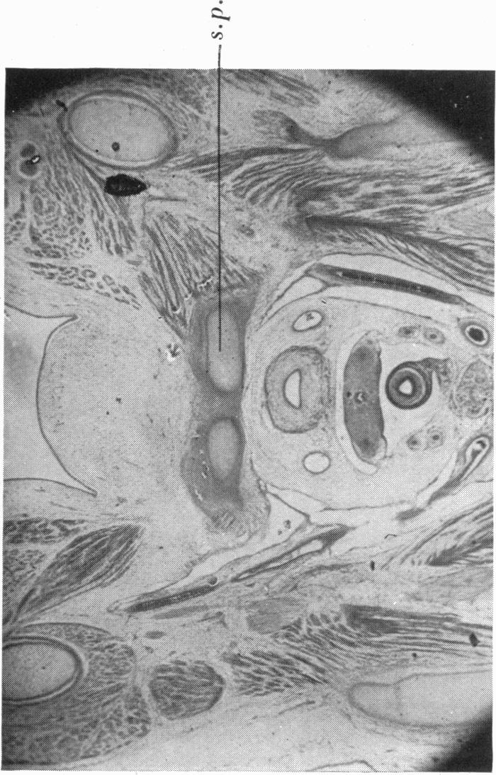 https://cdn.ncbi.nlm.nih.gov/pmc/blobs/60b3/1252341/cb4cbbb71a08/janat00531-0083-d.jpg