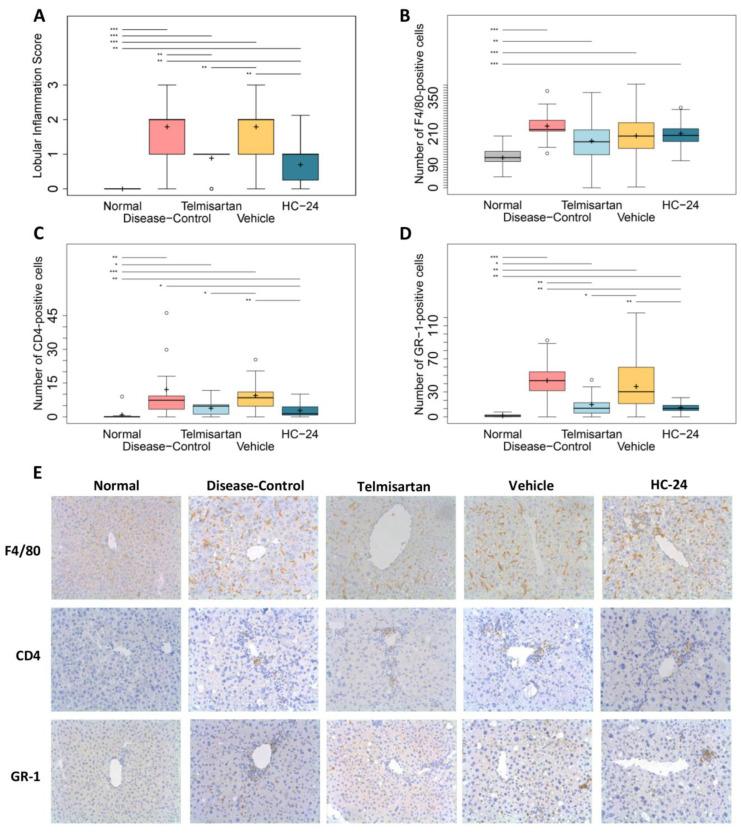 https://cdn.ncbi.nlm.nih.gov/pmc/blobs/60b7/10740479/ff9aa39d90ca/biomedicines-11-03216-g005.jpg