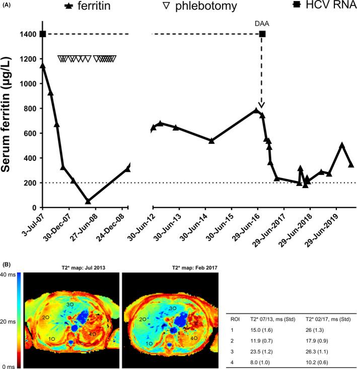 https://cdn.ncbi.nlm.nih.gov/pmc/blobs/60ba/7496278/20a0d7706928/LIV-40-1941-g004.jpg
