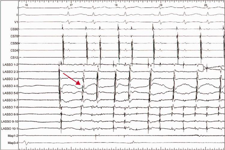 https://cdn.ncbi.nlm.nih.gov/pmc/blobs/60ba/8127776/947d3e2cdf02/10.1177_03000605211014375-fig3.jpg