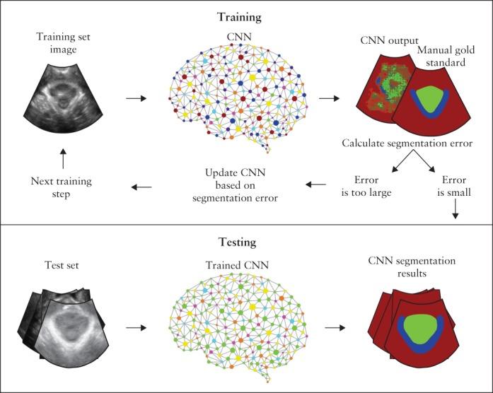 https://cdn.ncbi.nlm.nih.gov/pmc/blobs/60c7/6772057/9d177e52daa6/UOG-54-270-g002.jpg