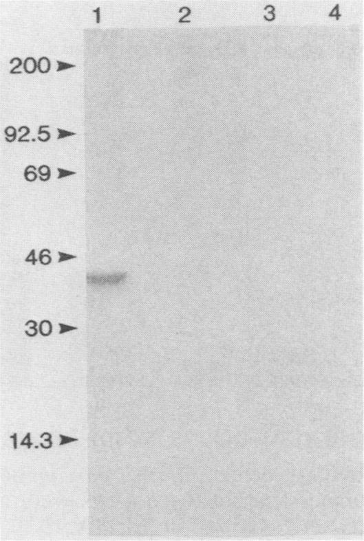 https://cdn.ncbi.nlm.nih.gov/pmc/blobs/60d2/268271/91d343b20271/jcm00060-0197-a.jpg