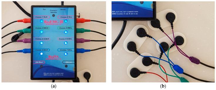 https://cdn.ncbi.nlm.nih.gov/pmc/blobs/60d8/7828563/6d3bc1fb9499/sensors-21-00541-g003a.jpg