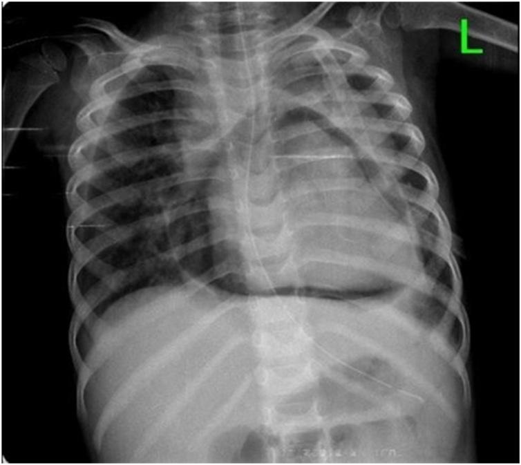 https://cdn.ncbi.nlm.nih.gov/pmc/blobs/60da/7566206/7e798bba3f27/gr2.jpg