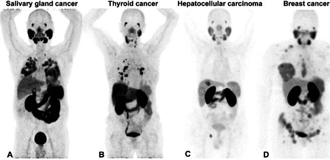 https://cdn.ncbi.nlm.nih.gov/pmc/blobs/60da/8566635/d50977df18da/259_2021_5433_Fig2_HTML.jpg