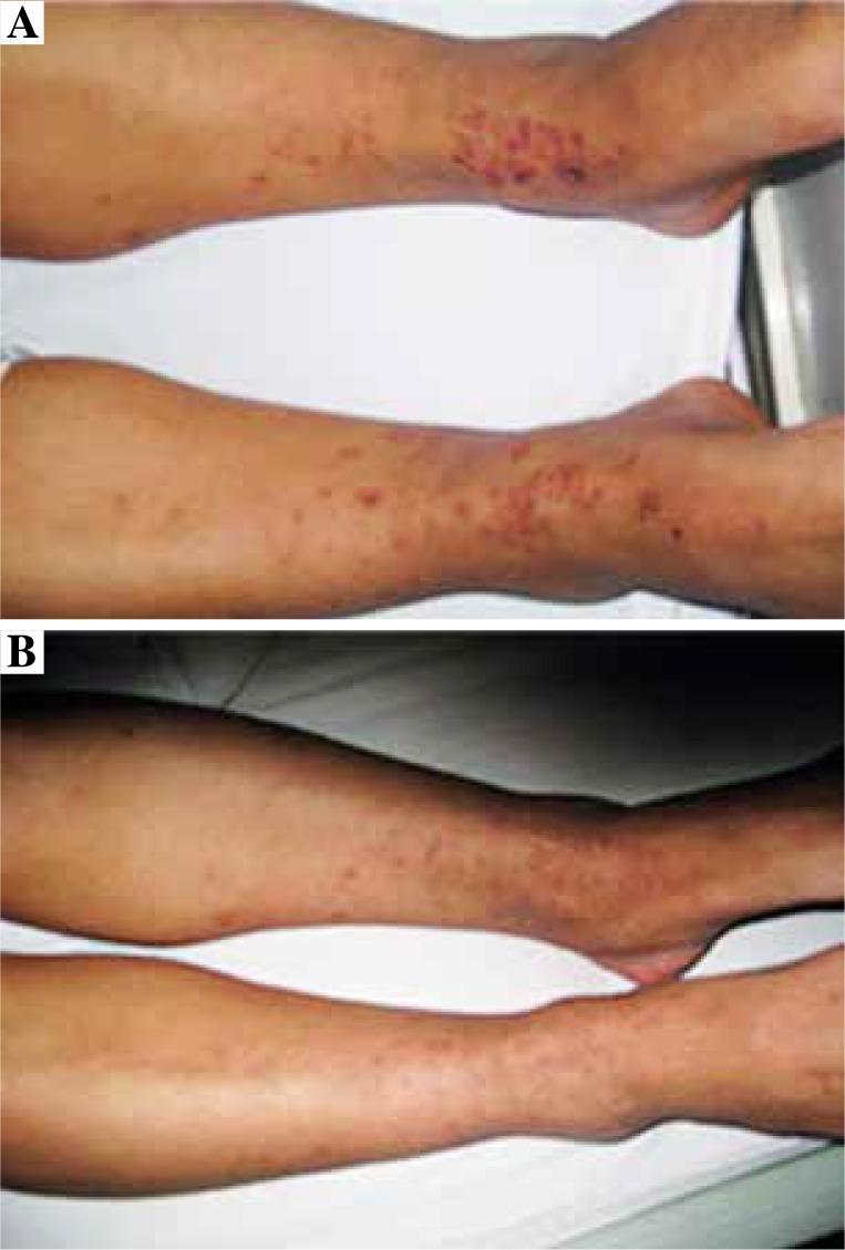 https://cdn.ncbi.nlm.nih.gov/pmc/blobs/60e7/6745548/a94ec03c6fec/CEJI-44-87064-g001.jpg