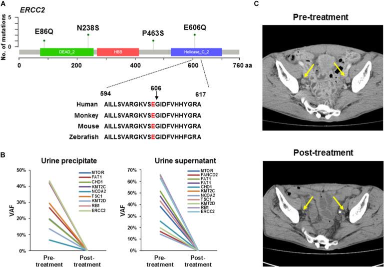 https://cdn.ncbi.nlm.nih.gov/pmc/blobs/60eb/7480179/ccbfe66ebfca/fonc-10-01643-g002.jpg