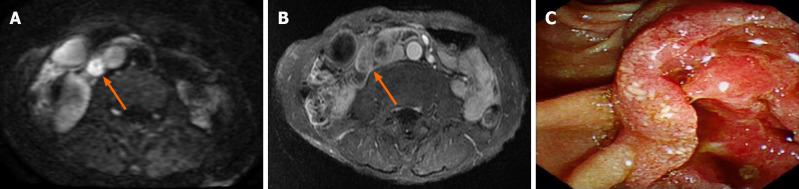 https://cdn.ncbi.nlm.nih.gov/pmc/blobs/60ef/8895167/b0f209646df2/WJCC-10-2268-g002.jpg
