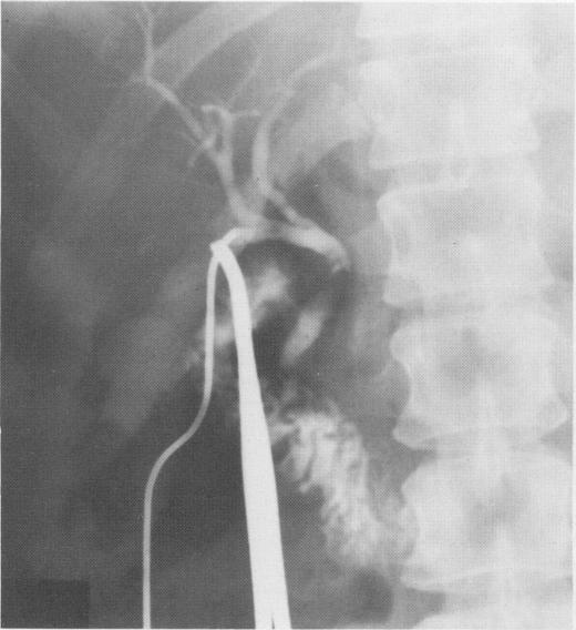 https://cdn.ncbi.nlm.nih.gov/pmc/blobs/60f1/2498233/4a0022973a37/annrcse01531-0034-b.jpg
