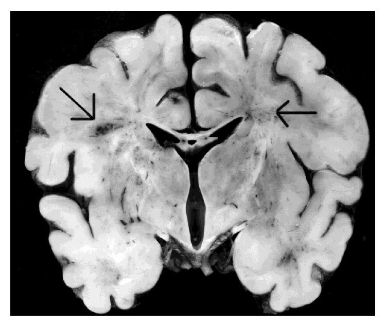 https://cdn.ncbi.nlm.nih.gov/pmc/blobs/60f1/4306255/8a061b467001/BMRI2015-257139.002.jpg