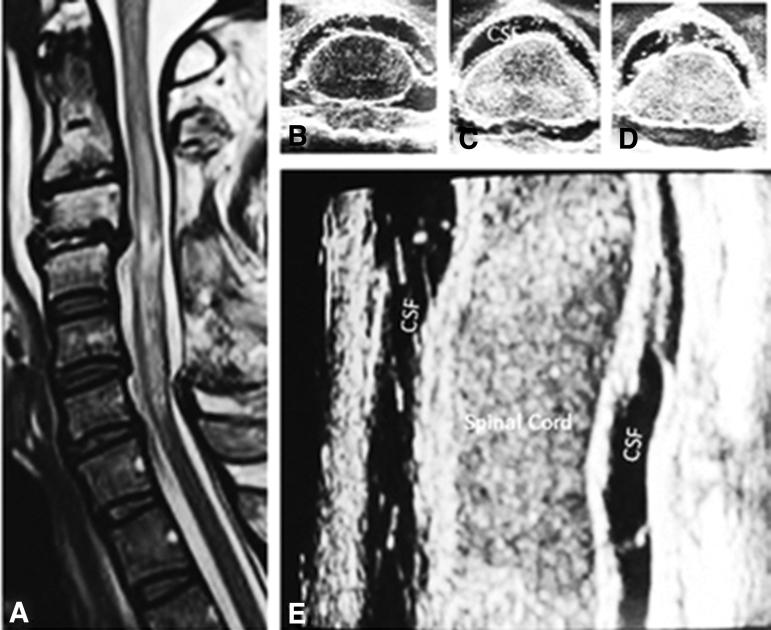 https://cdn.ncbi.nlm.nih.gov/pmc/blobs/60f3/9734016/ac533f4f8ca9/neu.2022.0218_figure5.jpg