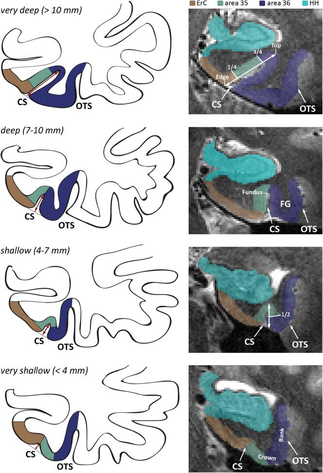 https://cdn.ncbi.nlm.nih.gov/pmc/blobs/60f8/5476466/3e75361568f6/gr5.jpg