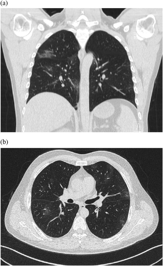 https://cdn.ncbi.nlm.nih.gov/pmc/blobs/60f9/7187859/693db688f10e/gr1_lrg.jpg