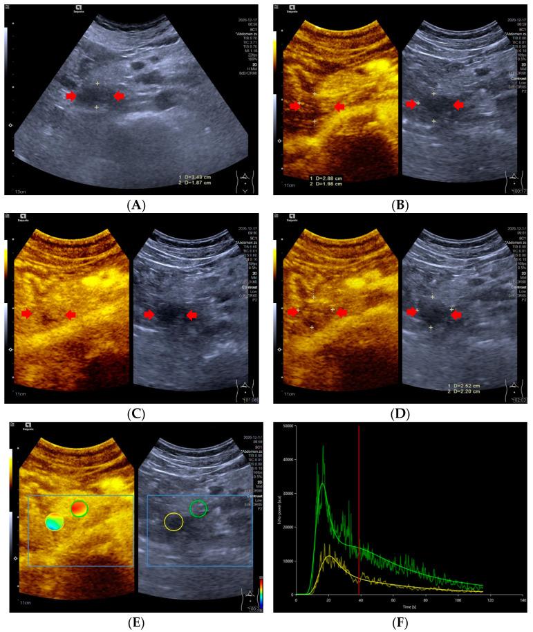https://cdn.ncbi.nlm.nih.gov/pmc/blobs/6107/9858178/0225a255261f/diagnostics-13-00238-g002.jpg