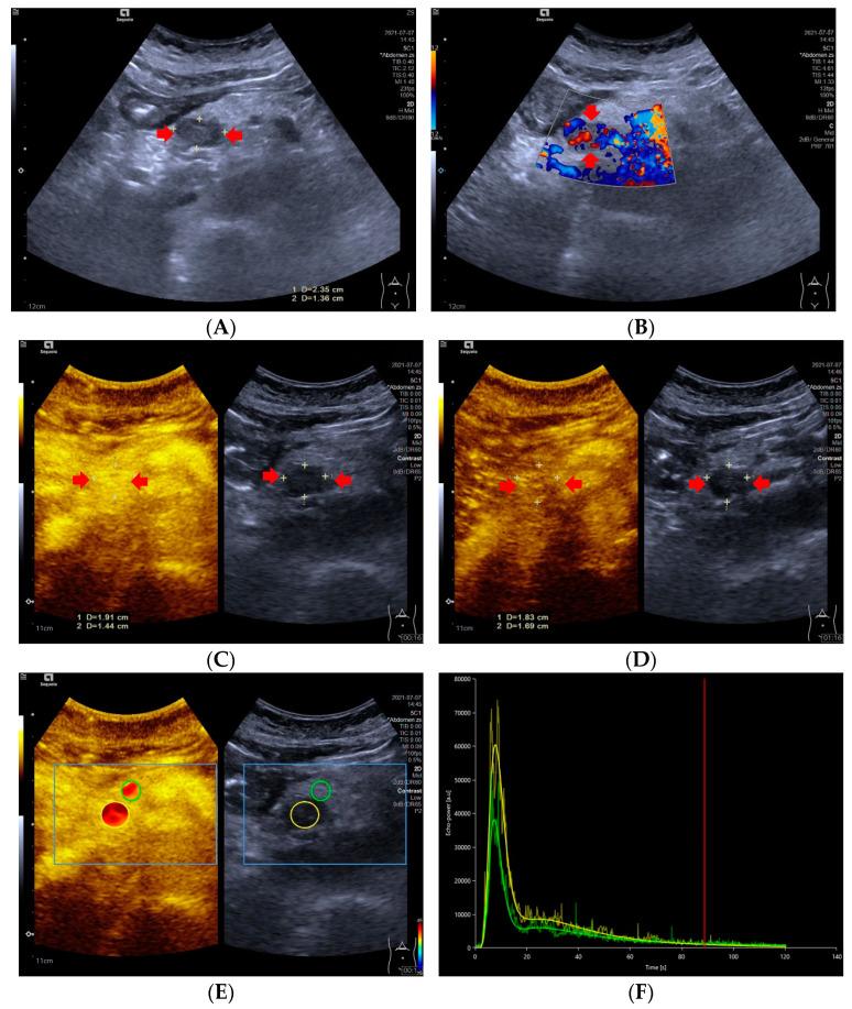https://cdn.ncbi.nlm.nih.gov/pmc/blobs/6107/9858178/2d6e3c9dd6dd/diagnostics-13-00238-g001.jpg