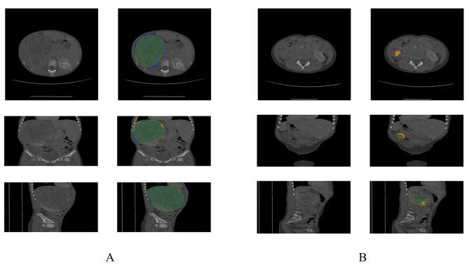 https://cdn.ncbi.nlm.nih.gov/pmc/blobs/6109/11080230/26ec2f3b16ca/12887_2024_4775_Fig2_HTML.jpg