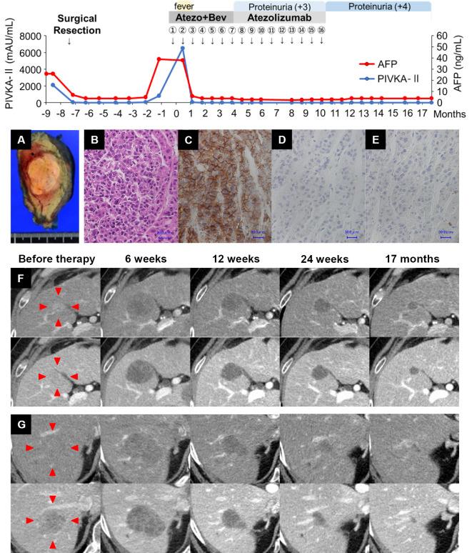 https://cdn.ncbi.nlm.nih.gov/pmc/blobs/6112/11081889/6a396af31ba0/1349-7235-63-1093-g001.jpg