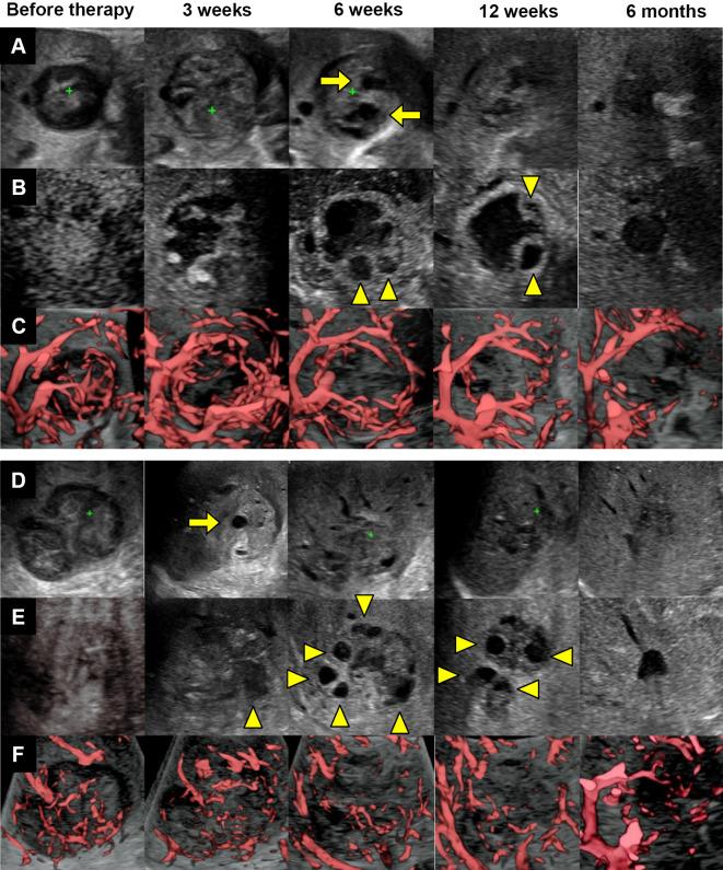 https://cdn.ncbi.nlm.nih.gov/pmc/blobs/6112/11081889/9599ca8c522e/1349-7235-63-1093-g002.jpg
