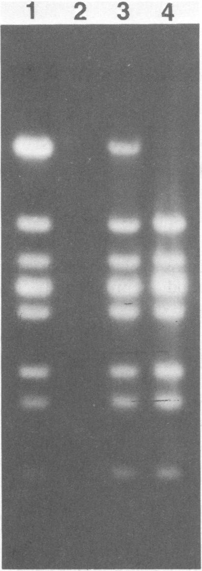 https://cdn.ncbi.nlm.nih.gov/pmc/blobs/6113/239300/f141c9f0a85b/aem00164-0295-a.jpg