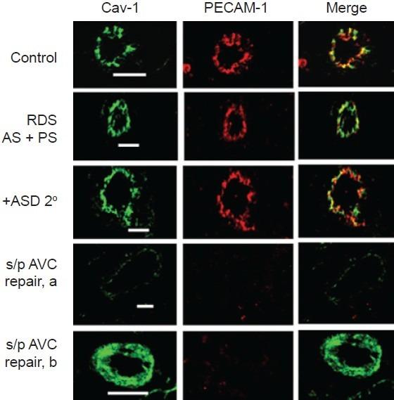 https://cdn.ncbi.nlm.nih.gov/pmc/blobs/6114/3555420/772ae70f6c95/PC-2-492-g005.jpg