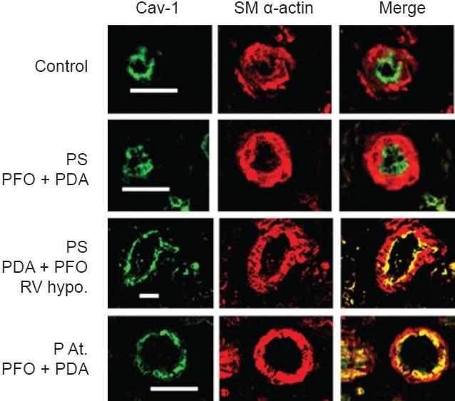 https://cdn.ncbi.nlm.nih.gov/pmc/blobs/6114/3555420/b5b07c69cc4a/PC-2-492-g003.jpg