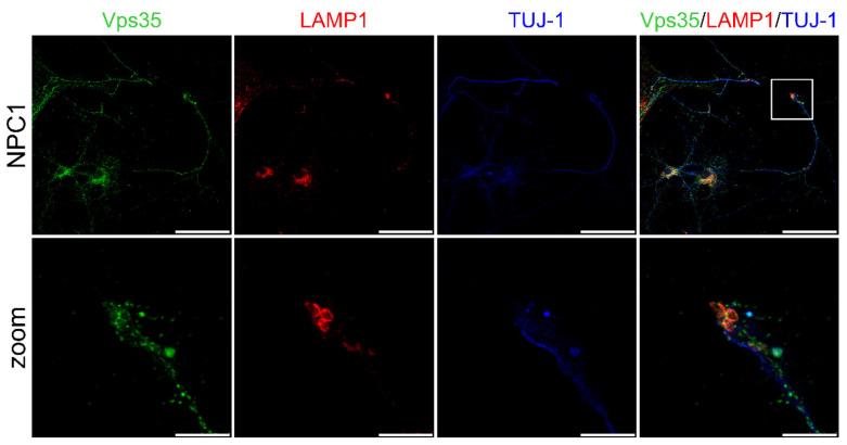 https://cdn.ncbi.nlm.nih.gov/pmc/blobs/6117/8705785/833403a91ef7/ijms-22-13256-g007.jpg