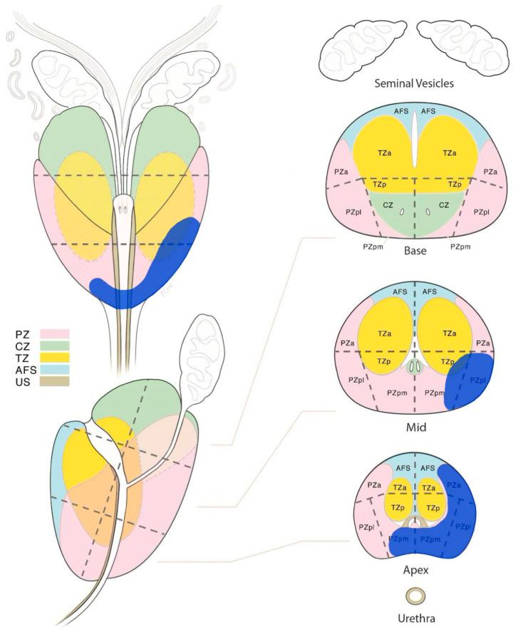 https://cdn.ncbi.nlm.nih.gov/pmc/blobs/611a/10529393/5996d2908cf8/curroncol-30-00576-g002.jpg