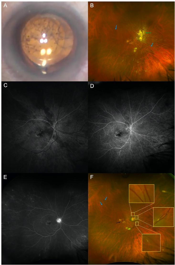 https://cdn.ncbi.nlm.nih.gov/pmc/blobs/611b/7695942/adbac492eb34/gr2.jpg