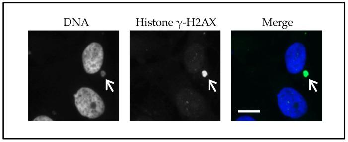 https://cdn.ncbi.nlm.nih.gov/pmc/blobs/612f/5713313/80fa51491fd7/ijms-18-02344-g002.jpg