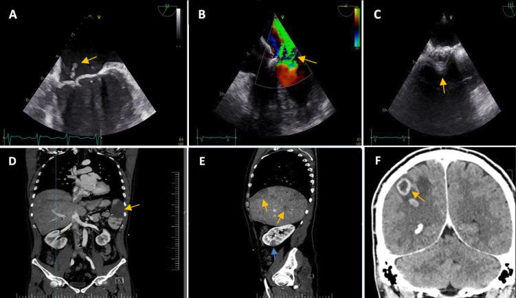 https://cdn.ncbi.nlm.nih.gov/pmc/blobs/6130/11792284/51d46df9517c/openhrt-12-1-g007.jpg