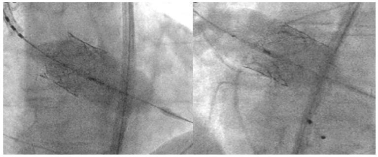 https://cdn.ncbi.nlm.nih.gov/pmc/blobs/6137/10672483/489de67d527e/jcm-12-07074-g006.jpg